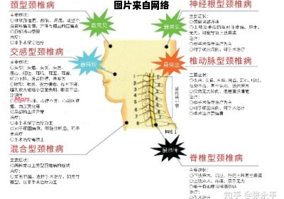 颈椎炎的症状有哪些表现？